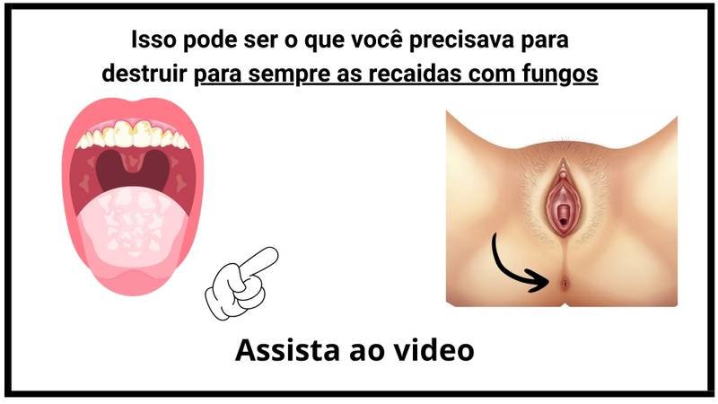 Capa do Vídeo - Saúde Íntima Feminina